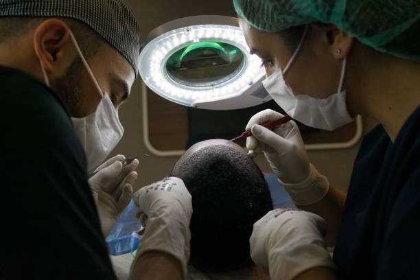 Threads of Change: Riyadh's Perspective on Advanced Hair Transplantation
