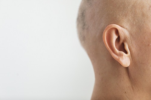 What Causes Ear Veins and How are They Treated