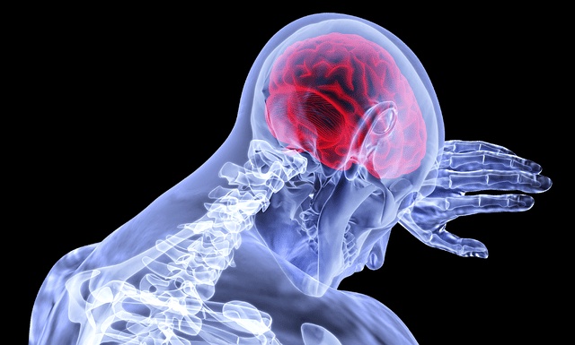 What to Expect from Treatment for Traumatic Brain Injuries