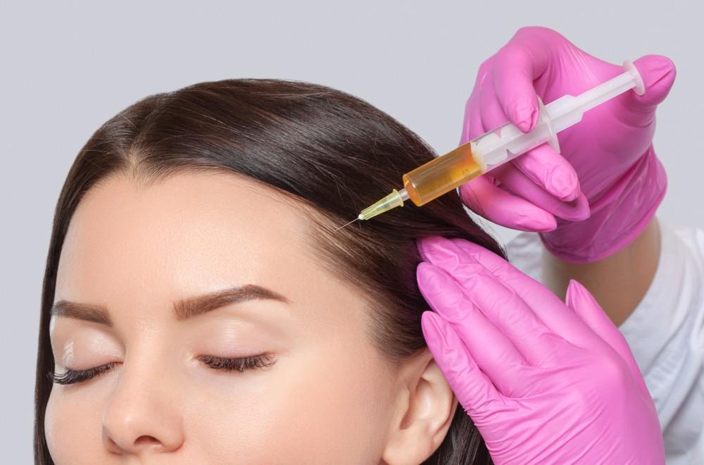 PRP for Hair Loss: Fact or Fiction?