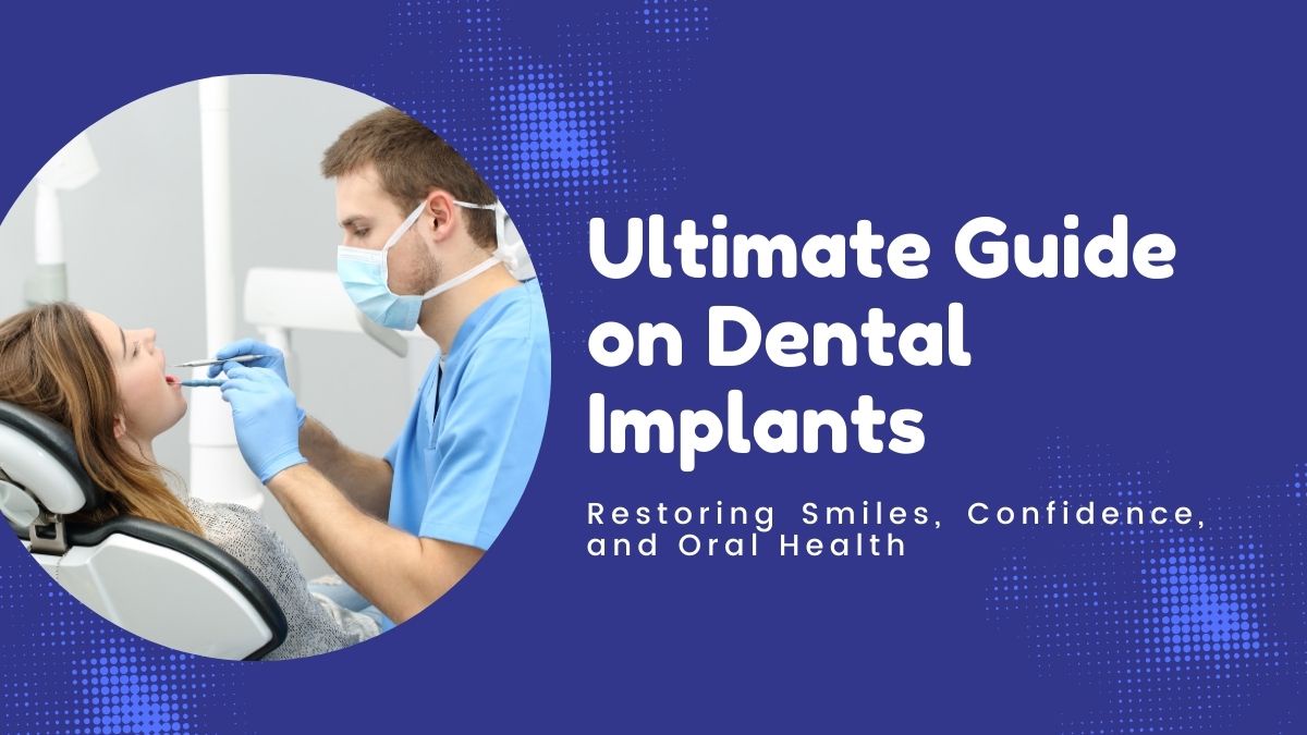 Ultimate Guide on Dental Implants: Restoring Smiles, Confidence, and Oral Health