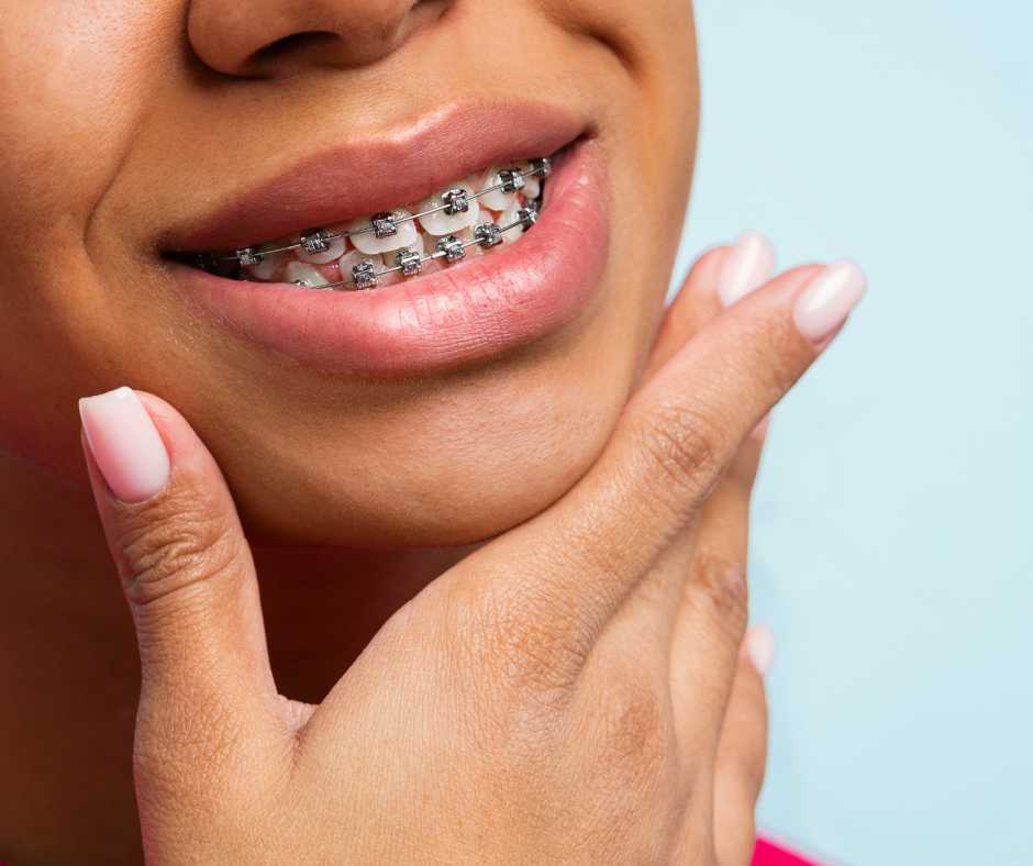 The Science of Smiles: Exploring Orthodontics
