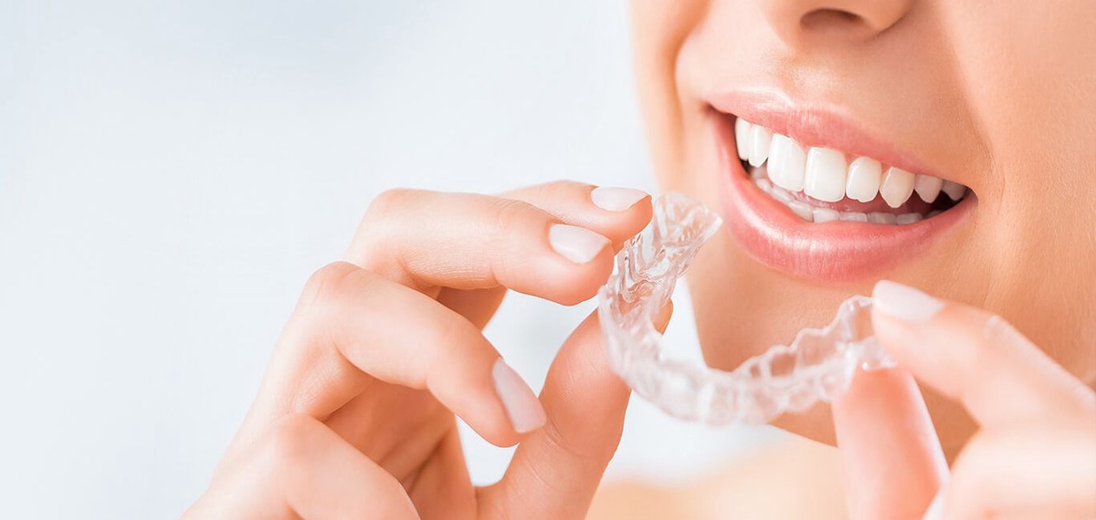 Your Path to the Best Invisalign Treatment