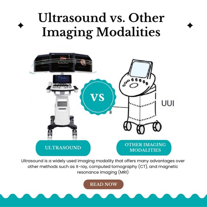 Comparing Ultrasound to Other Imaging Techniques: A Comprehensive Overview