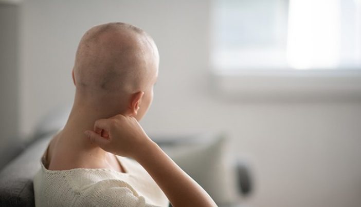 Lifestyle Impact of Hair Transplant Treatment