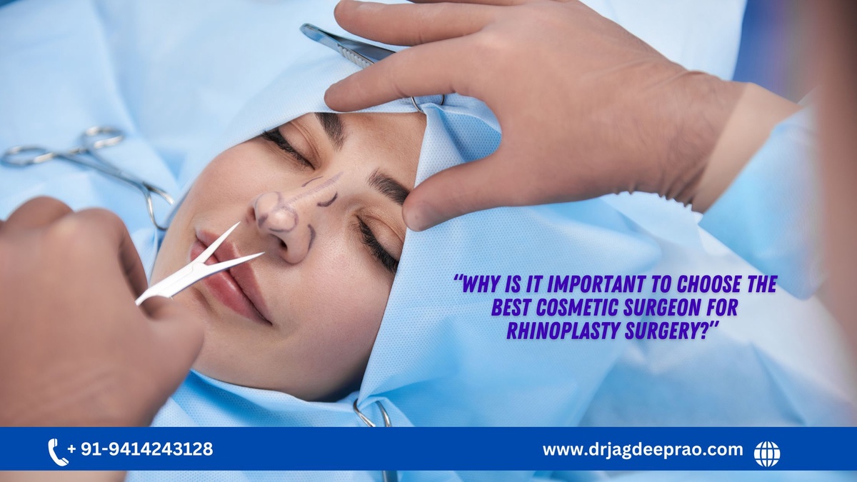 Why Is It Important To Choose The Best Cosmetic Surgeon For Rhinoplasty Surgery?