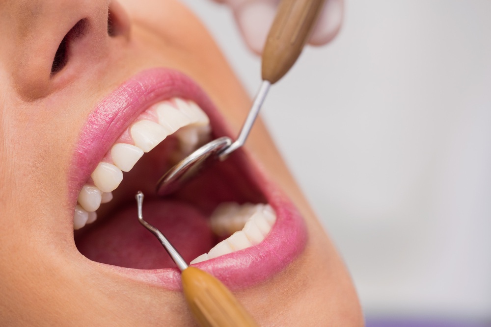The Ultimate Guide to Dental Care Services in Long Beach