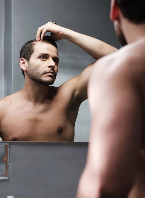 What is the Success Rate of Body Hair Transplants?