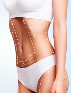 Who Need Liposuction in Izmir Turkey?