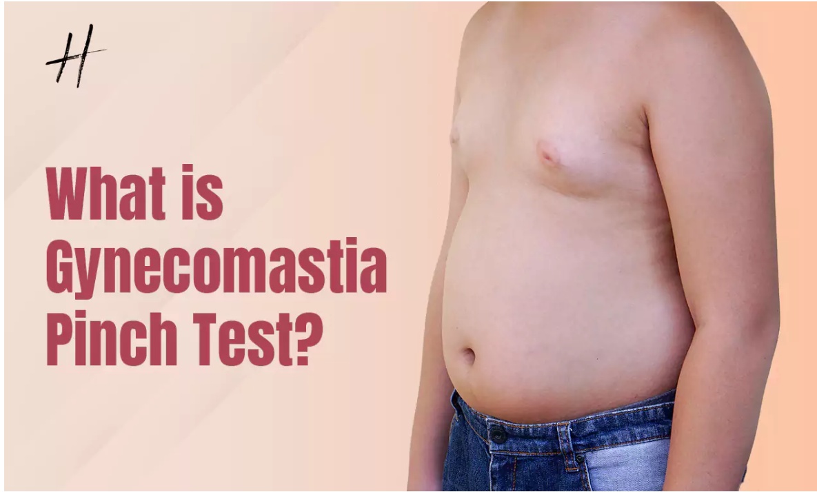 How To Perform the Gynecomastia Pinch Test