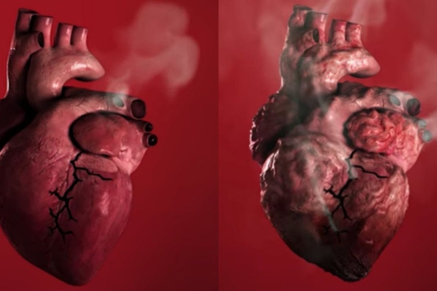 Why is smoking bad for your heart?