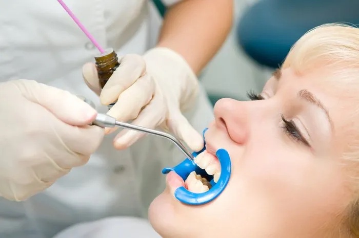 Guardians of Smiles: The Benefits of Dental Sealants in Lake Mary