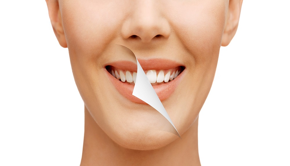 Exploring the Benefits of Teeth Whitening in Windsor Consultation