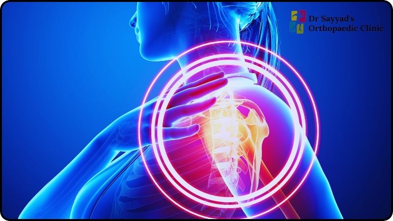 Elevating Orthopedic Excellence: Dr. Sana Sayyad and the Art of Shoulder Replacement in Pune