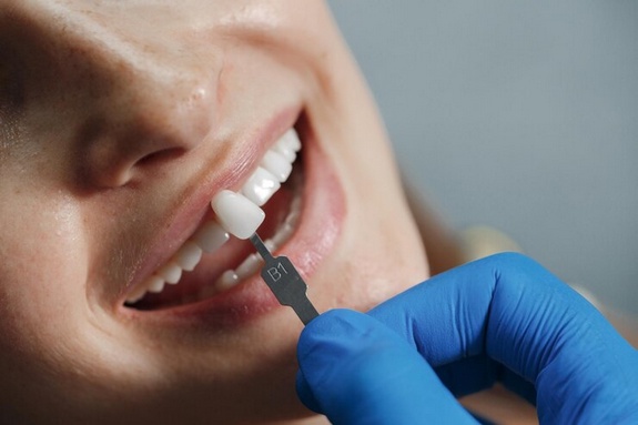 Medford's Smile Makeover: The Art and Science of Cosmetic Dentistry