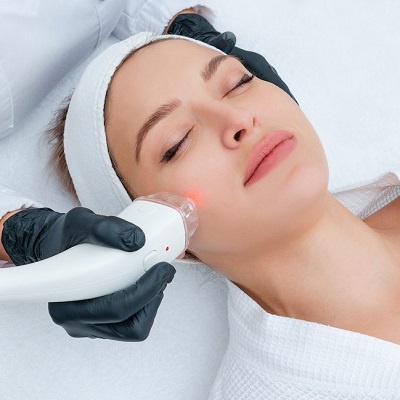 Laser Hair Removal: Your Ultimate Guide to Smooth, Lasting Results
