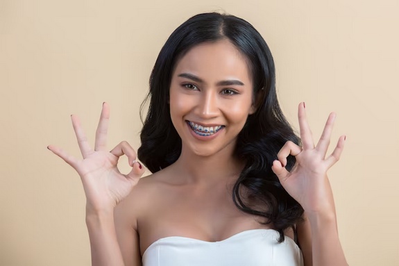 Unseen Brilliance: Transform Your Smile with Invisible Braces in Miami