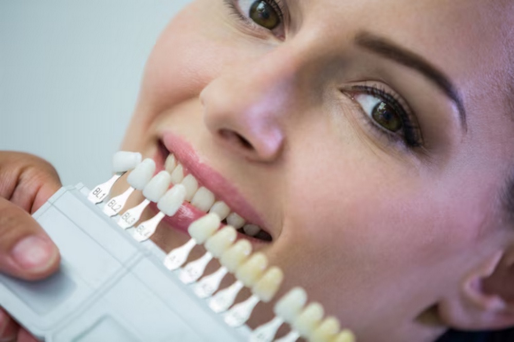 Enhancing Your Smile: The Art of Dental Veneers in Essex