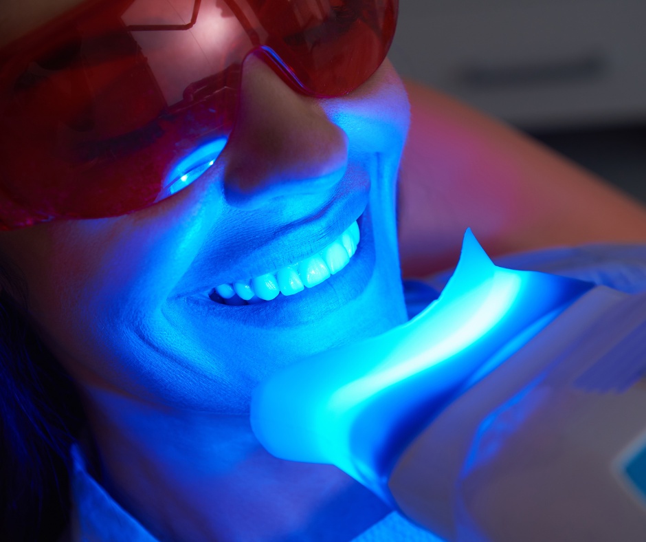 Teeth Whitening 101: Unveiling the Secrets to a Brighter Smile