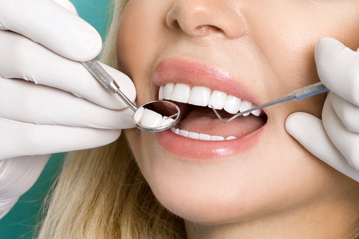 Unveiling the Art of Restorative Dentistry for a Radiant Smile
