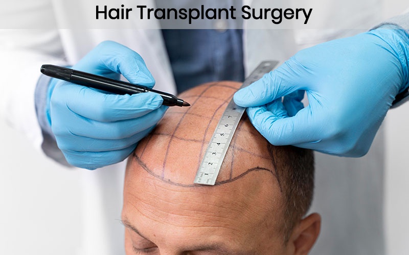 Hair Transplant cost in Bangalore