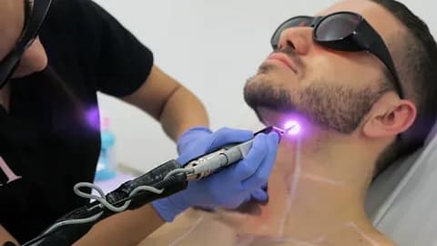 Laser Hair Removal Training: Your Path to Precision and Success