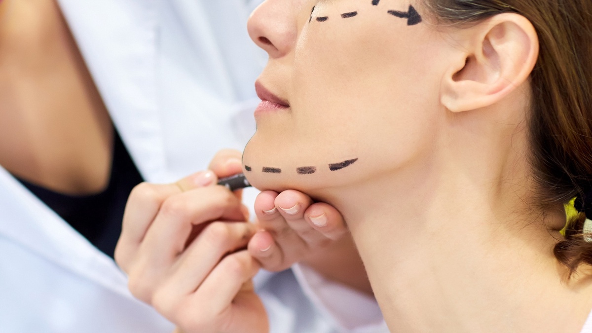 How Facelift Surgery Redefines Youthfulness