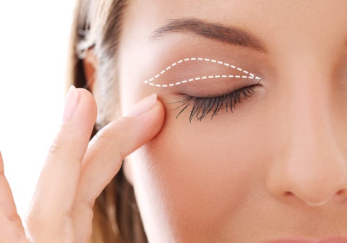 Are Your Eyelids Sagging? Try These Proven Solutions