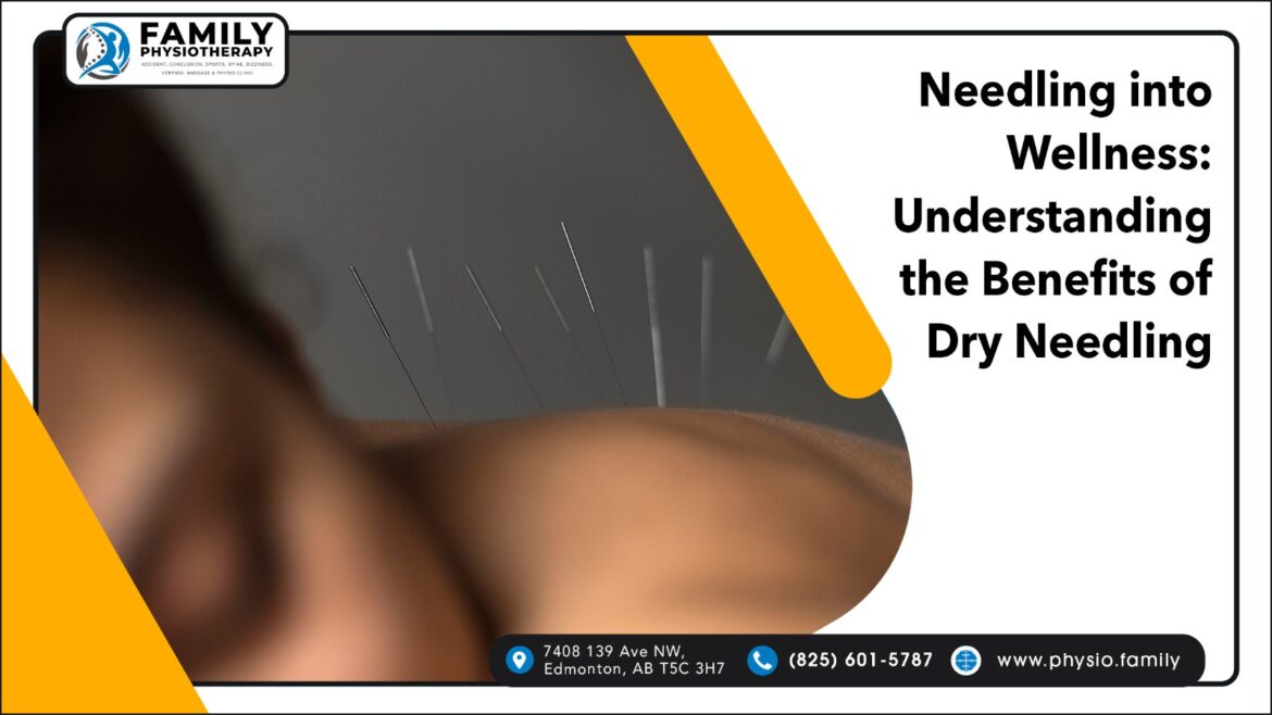 How Can Dry Needling Therapy in Edmonton by Family Physiotherapy Help You Discover Relief?