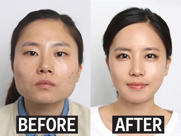 The Line Plastic Surgery Clinic: Experience, Precision, and Affordability in Seoul
