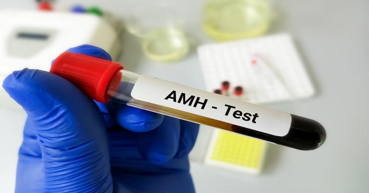 Navigating Prime IVF: The Importance of AMH Evaluation