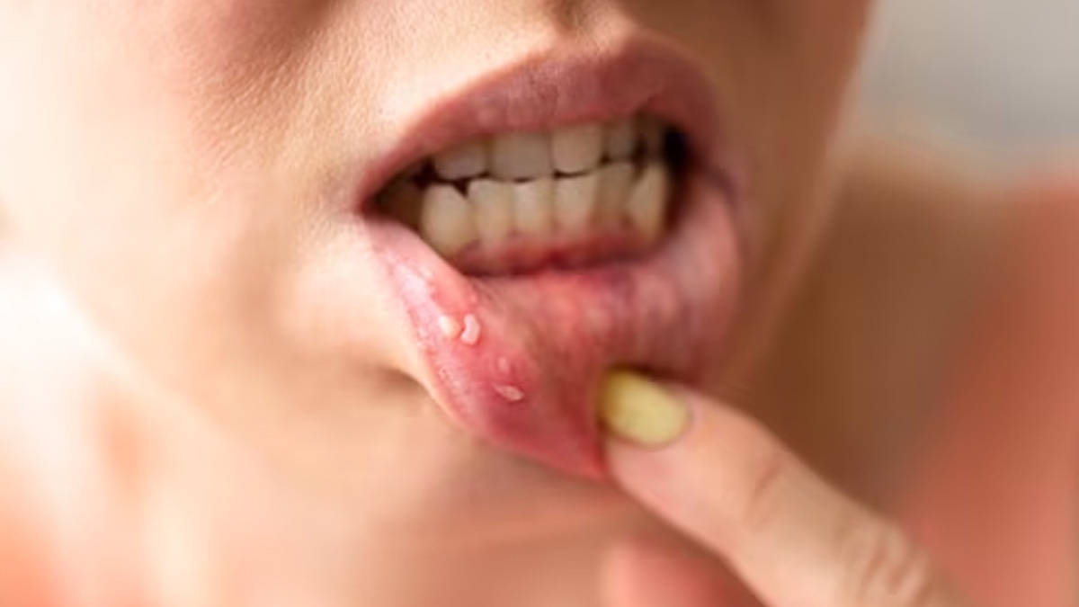 Holistic Wellness: Ayurvedic Practices For Oral Cancer Survivors