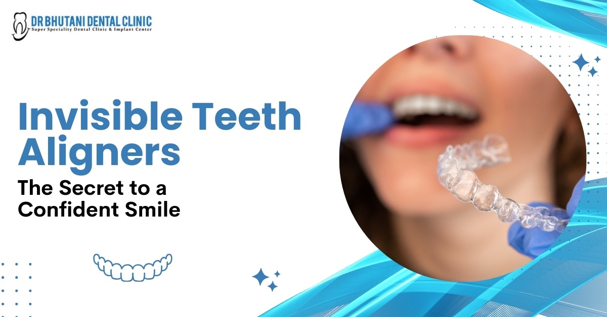 Invisible Teeth Aligners The Secret to a Confident Smile