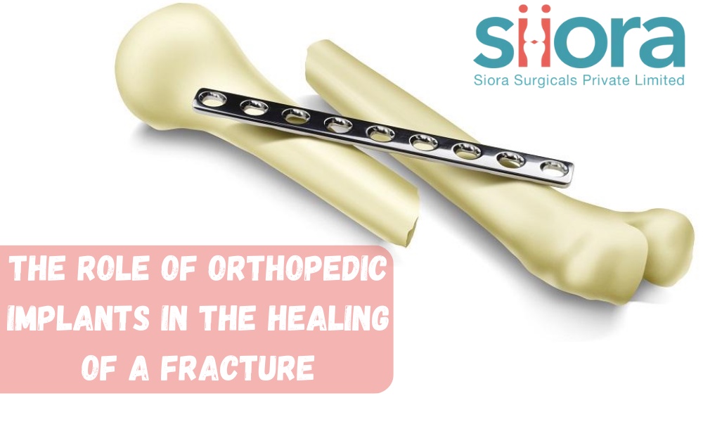 The role of Orthopedic Implants in the Healing of a Fracture