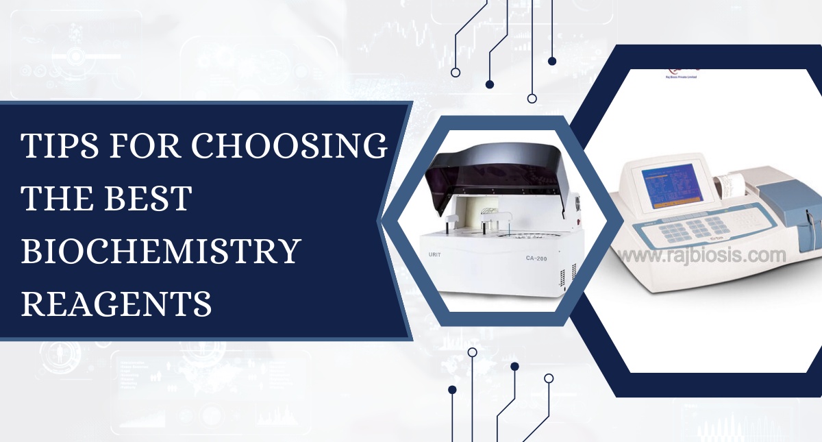 Tips for Choosing the Best Biochemistry Reagents