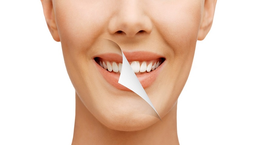Everything About Teeth Whitening And Its Services