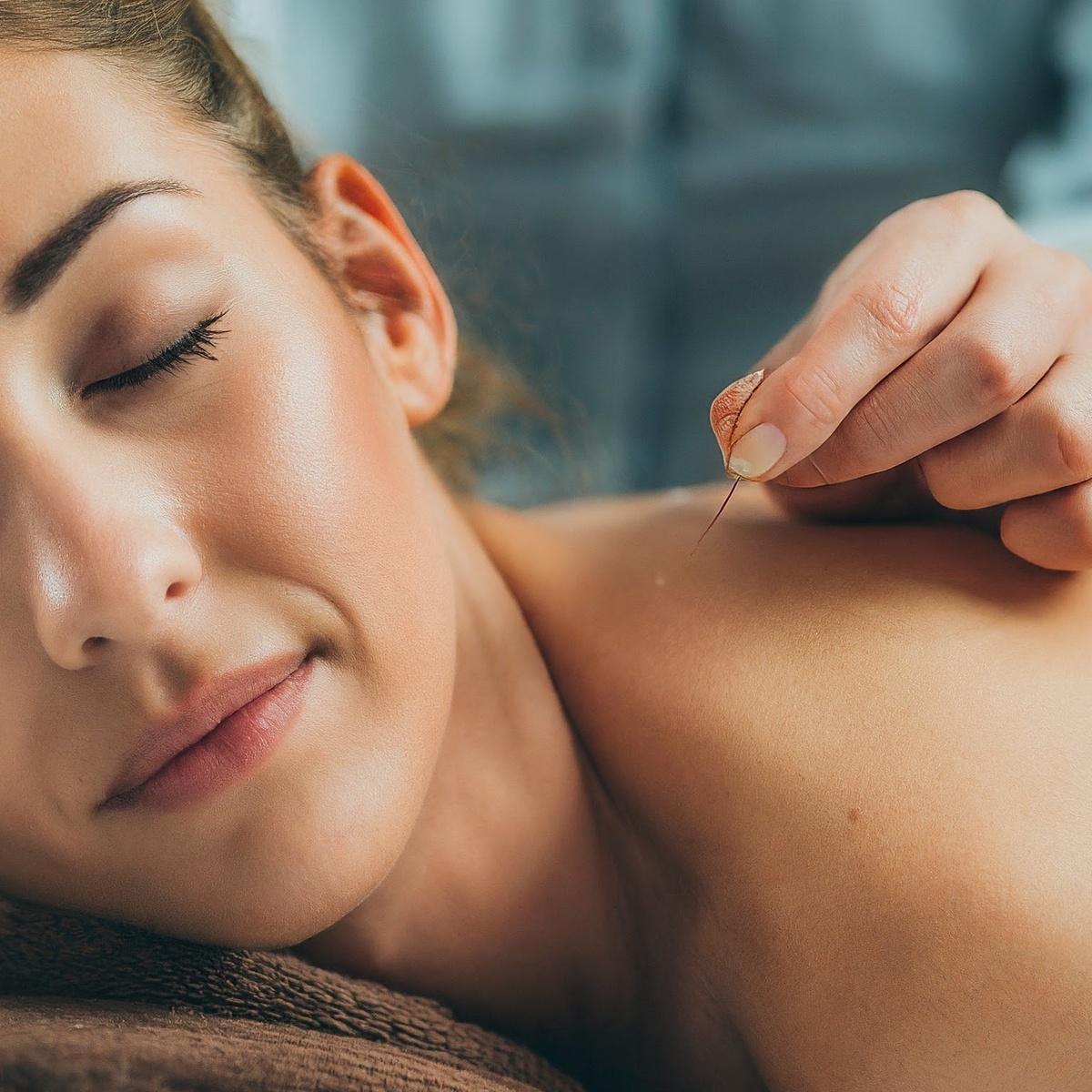 Exploring the Connection: Acupuncture and Better Sleep