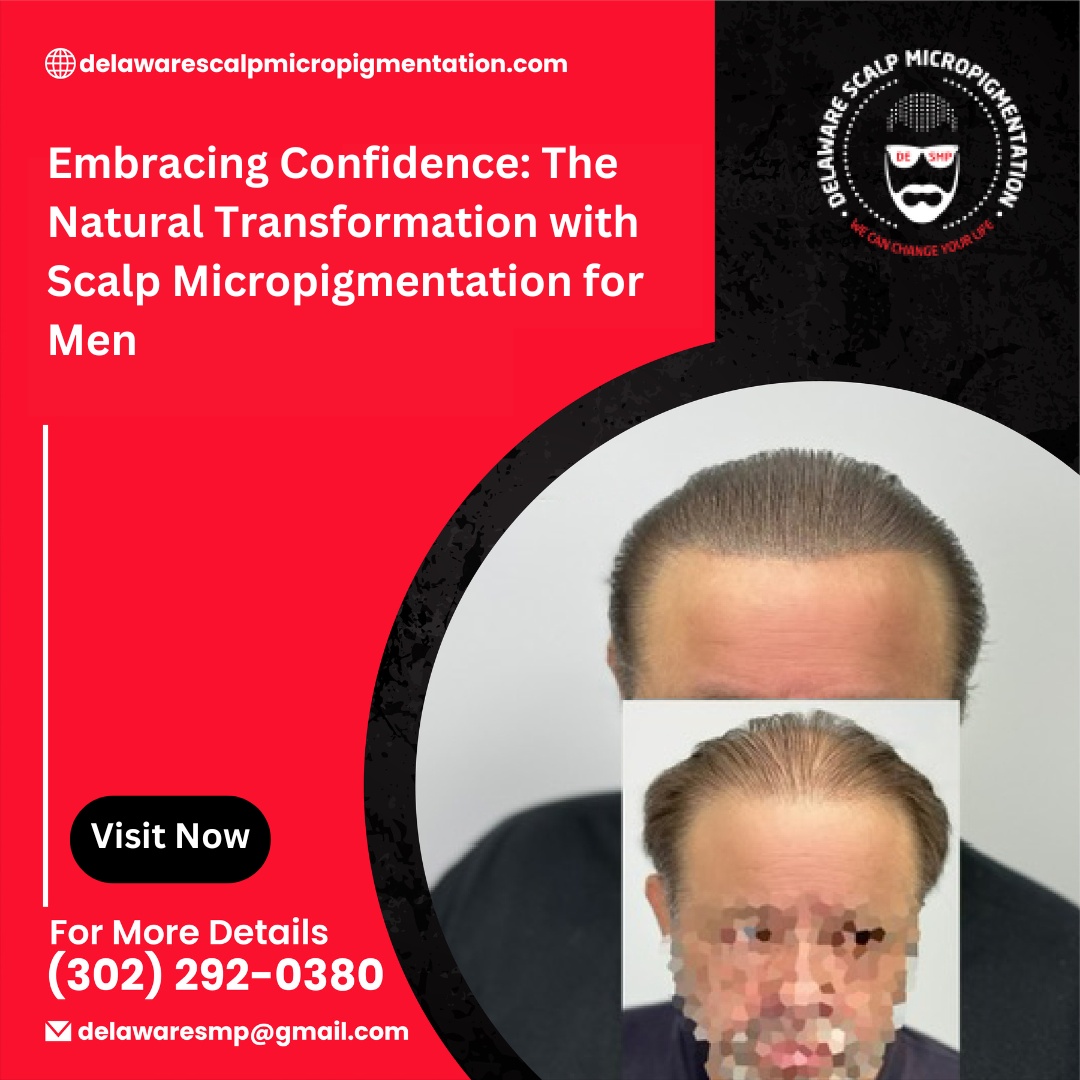 Embracing Confidence: The Natural Transformation with Scalp Micropigmentation for Men