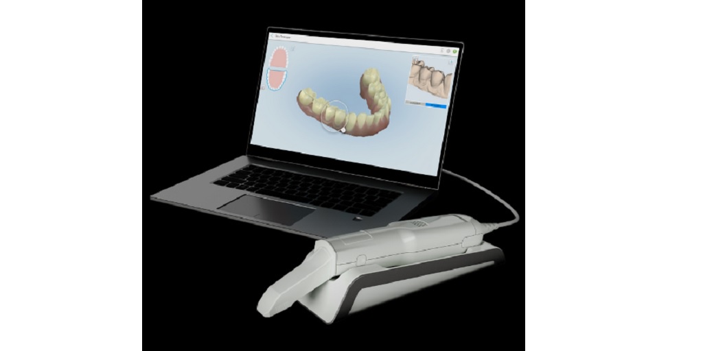 Choosing an Intraoral Scanner for Your Dental Practice