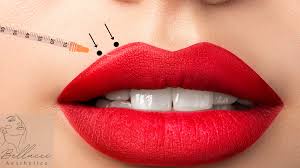 Aesthetic Lip Enhancement: Achieve the Perfect Pout