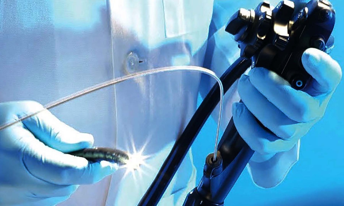 Endoscopy Unleashed: Harnessing Technology for Better Health Outcomes