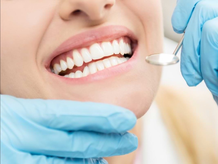 How Professional Teeth Whitening Can Enhance Your Smile Confidence