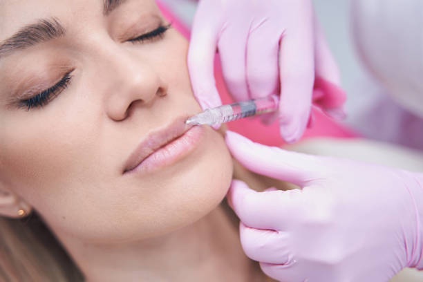Get Noticed with Lip Fillers in Abu Dhabi