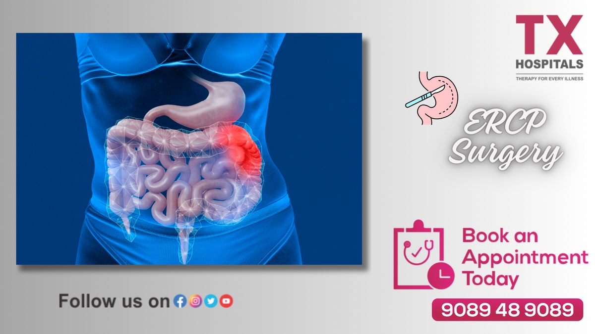 Expert ERCP Surgery in Hyderabad | Skilled Gastroenterologists
