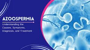 From Diagnosis to Solution: A Comprehensive Guide to Azoospermia Treatment