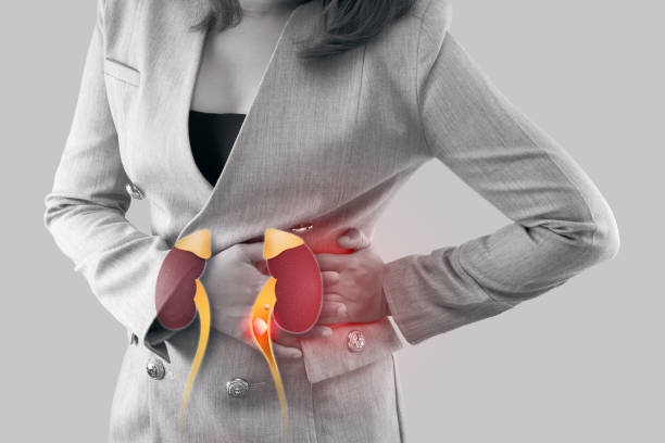 5 Surprising Symptoms of Kidney Stones