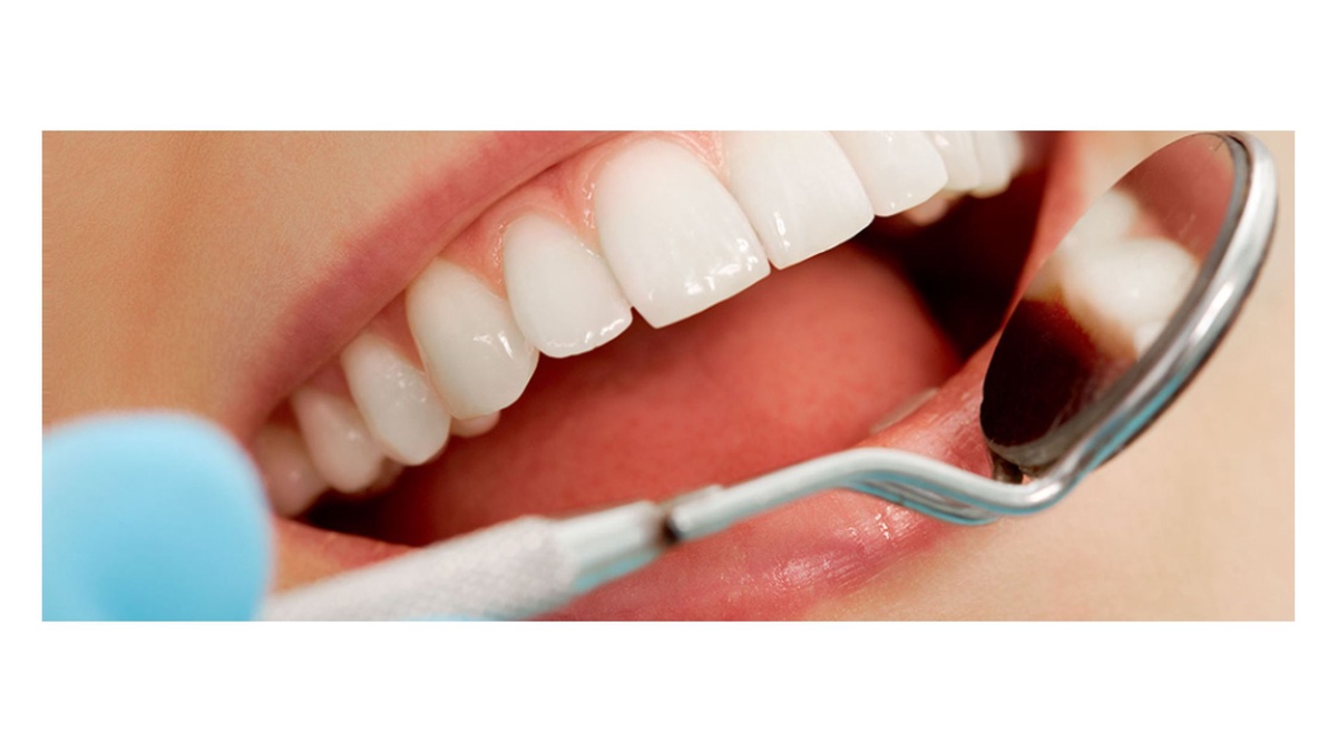 Top 10 Reasons Why General Dentistry Should Be Your Priority