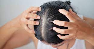 Incorporating Scalp Massage into Your Routine for Thinning Hair