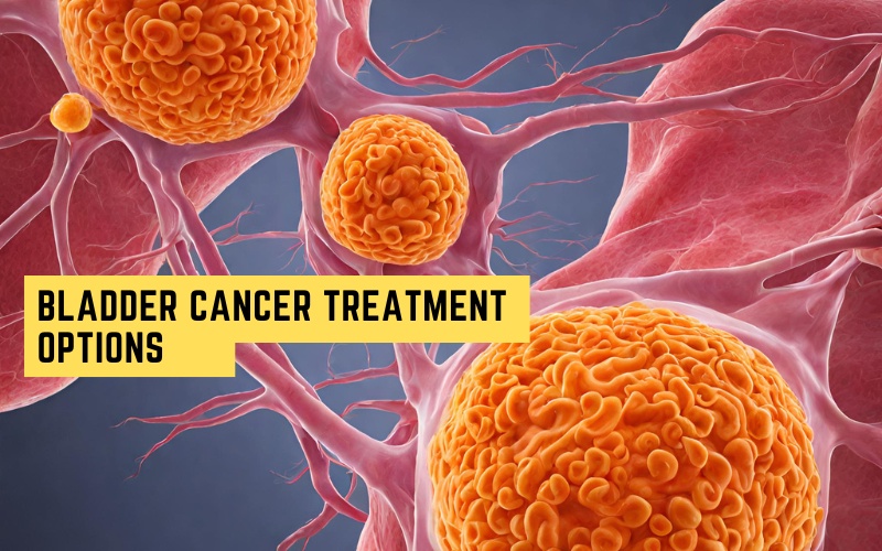 The Latest in Bladder Cancer Treatment
