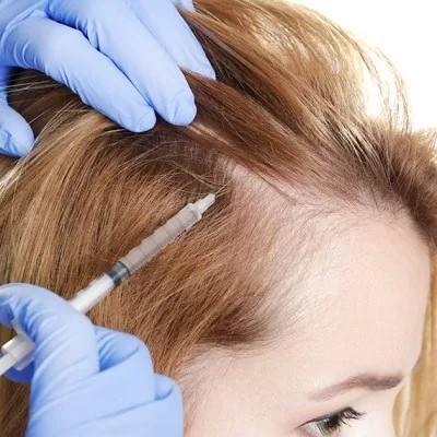 Before, During, and After: What to Expect with PRP Hair Treatment